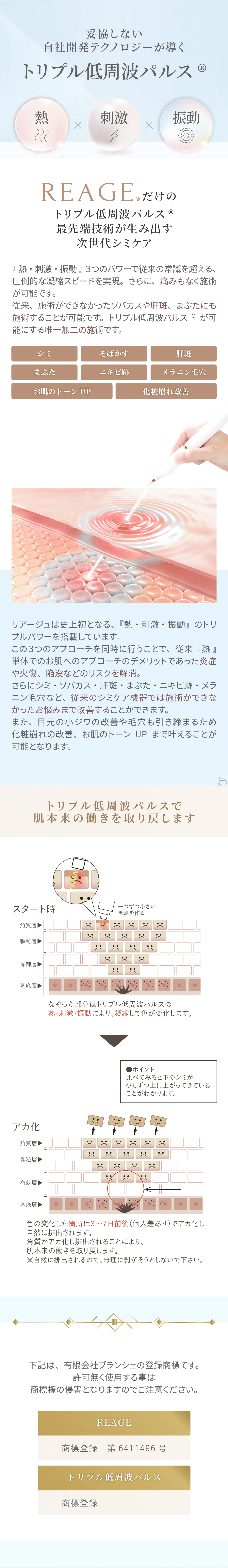 トリプル周波パルス